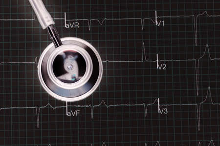 Stethoscope on the electrocardiogram (ECG) graph (top view)