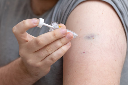 Obese young man applying anticoaculant injection after bariatric surgery.の写真素材