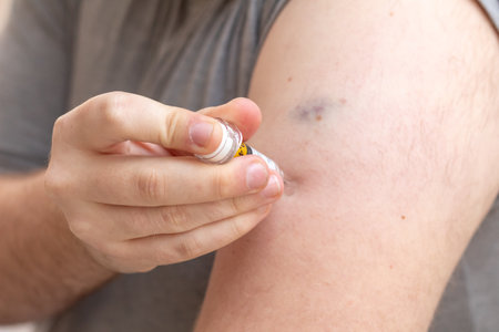 Obese young man applying anticoaculant injection after bariatric surgery.の写真素材