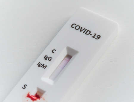 Quick test or diagnostic test to detect Covid-19 or SARS-CoV-2 in humans. Detects igg and igm by obtaining antibodies.の写真素材