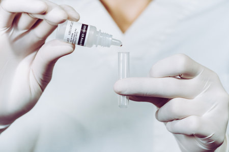 A nurse wearing latex gloves puts drops from the serological bottle into the tube and then rubs the...