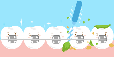 cute cartoon tooth wear brace with brushesのイラスト素材
