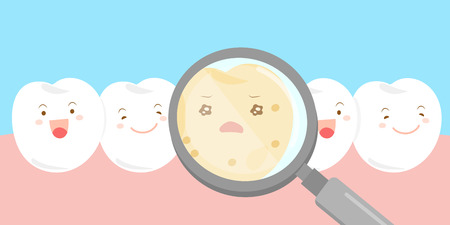 Cute cartoon tooth with decay and magnifyingのイラスト素材