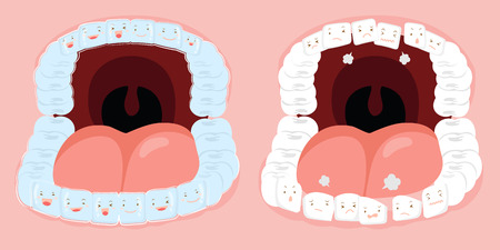 cute cartoon tooth wear invisible braces with arranged irregularly problemのイラスト素材