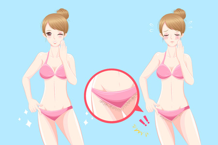 Cute cartoon woman with bikini line problem before and after.のイラスト素材