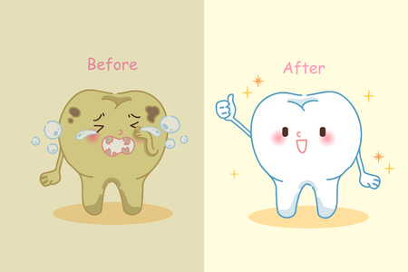 cute cartoon tooth whitening before and afterのイラスト素材