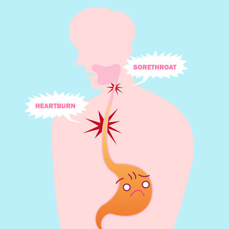 Cute cartoon stomach with health concept on the blue backgroundのイラスト素材