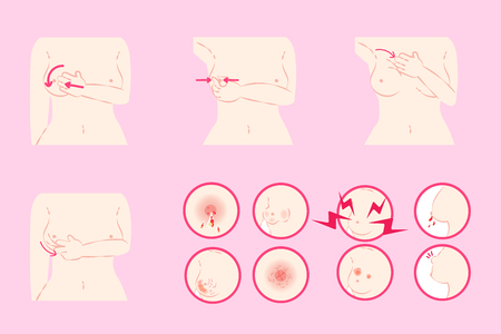 woman with breast cancer symptom on the pink backgroundのイラスト素材