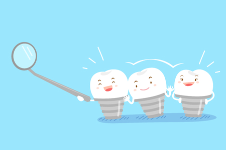 cartoon implant tooth on the blue backgroundのイラスト素材