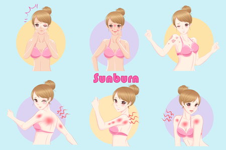 Cute cartoon woman with sunburn problem in the summerのイラスト素材