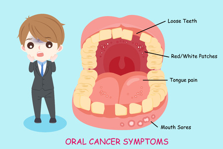man with oral cancer symptoms on the blue backgroundのイラスト素材