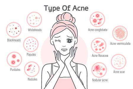 upset cartoon woman touch her face with  skin problemsのイラスト素材