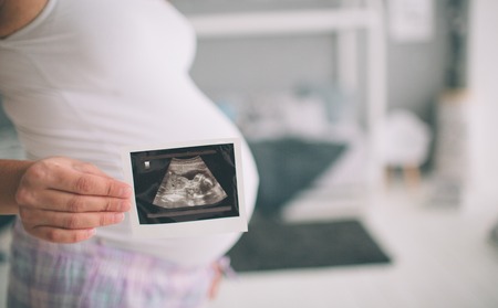 Pregnant woman holding ultrasound scan. Concept of Pregnancy health careの写真素材