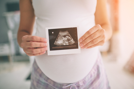 Pregnant woman holding ultrasound scan. Concept of Pregnancy health careの写真素材