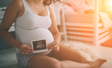 Pregnant couple holding ultrasound scan. Concept of Pregnancy health careの写真素材