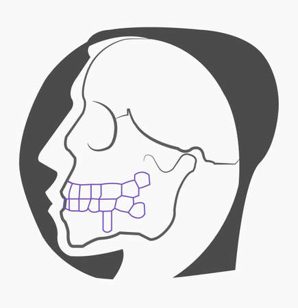 x-ray scan of a man's headのイラスト素材