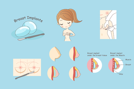 cartoon woman doing breast implant, beautyのイラスト素材
