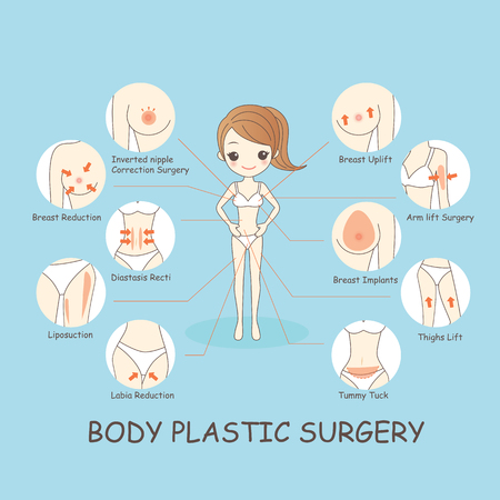cartoon woamn body plastic surgery, great for healthy conceptのイラスト素材
