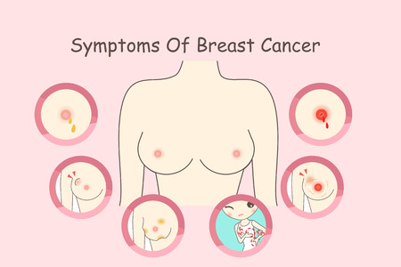 symptoms of breast cancer,great for your designのイラスト素材