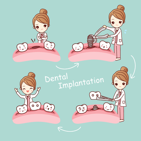 cute cartoon tooth implant treatment with dentist, great for health dental care conceptのイラスト素材