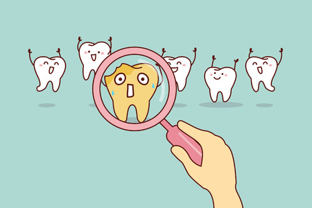 cartoon decay tooth with magnifying glass, great for health dental care conceptのイラスト素材