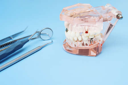 Dentist tools and artificial jaw on a blue background. The concept of dental care and going to dentistry.の写真素材