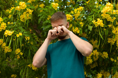 Portrait of handsome young allergic man is suffering from pollen allergy or cold on natural flowers, flowering tree background at spring or sunny summer day, sneezes, blowing his runny nose rubs eyesの写真素材