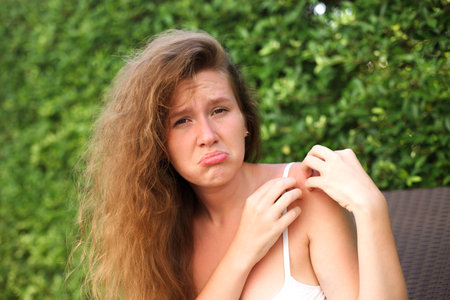 Irritated young suffering woman scratching her itching arm from a mosquito bite at the park at summer sunny day, itchy insect biteの写真素材