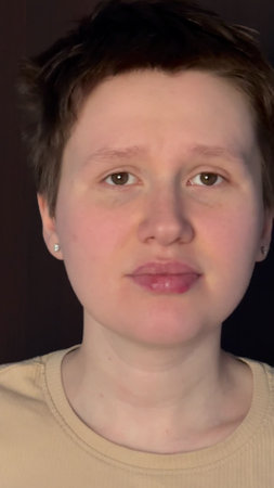 young woman has problems with herpes on her lip