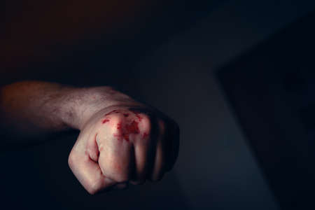 Clenched Left Hand Fist with Bloody and Bruised Knuckles Prepared to Punch Again. Domestic Violence, Abuse or Family Violence Concept.の写真素材