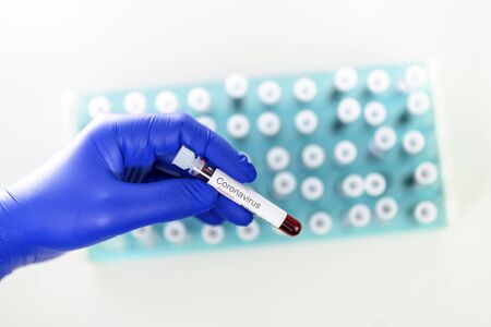 Health worker holds one test-tube indicating positive results of corona virus test. Many blood tube-tests in special holder as a background.の写真素材
