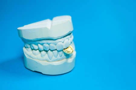 Hand holds a dental splintの写真素材