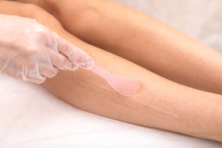 Laser hair removal on legs, hair removal by radiation. Spread a cooling cream on the skin before the...