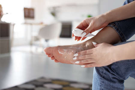 Tired woman using pain relief cream for foot after fatigue, long walking, working, standing, flat feet or injury, sitting indoors. Suffering from hurt of arch, ball, heel or toe treatmentの写真素材