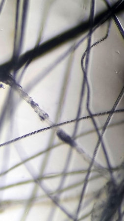 Microscopic image of cat fur affected by ringworm. Individual hairs are clearly visible under...