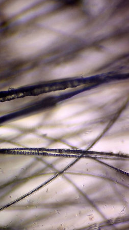 Microscopic image of cat fur affected by ringworm. Individual hairs are clearly visible under magnification, showing characteristic damage and deposits of fungal infection. In some places, the hair structure is destroyed, and accumulations of spores and plaque are visible. The background is light, which emphasizes the dark threads of the fur and the affected areas. The image is suitable for use in educational and scientific materials, veterinary publications, articles on dermatophytosis and skin diseases of animals, as well as in medical and microbiological research.の写真素材