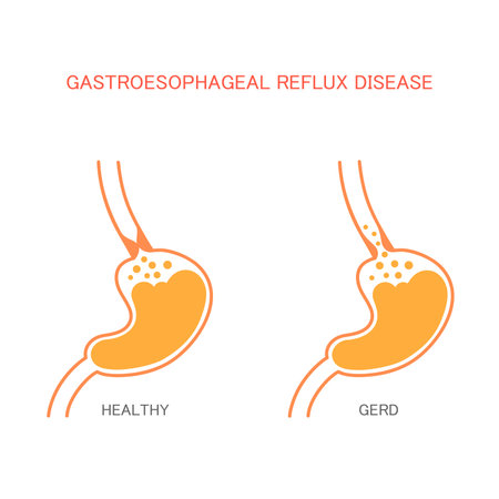 heartburn reflux disease stomach pain human gastric acidのイラスト素材