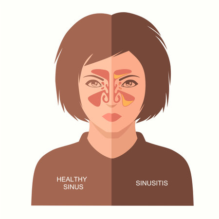 sinusitis disease vector illustration nose, sinus anatomy, human respiratory systemのイラスト素材