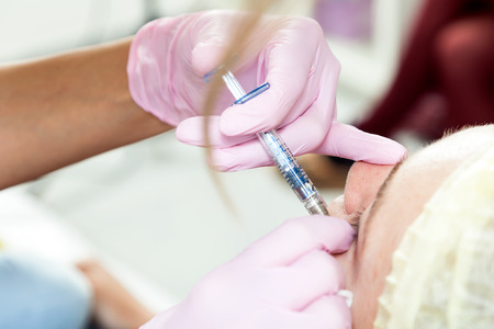 Close-up of a female cosmetician injecting an injection into the cheekbones of a young woman to correct the shapeの写真素材