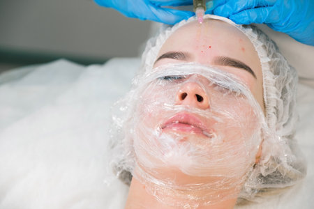 PRP therapy in beauty clinic. Cosmetologist doing injections of blood plasma to womans forehead to cure problem skin, closeup top view. Treatment of skin in cosmetology for young female.の写真素材