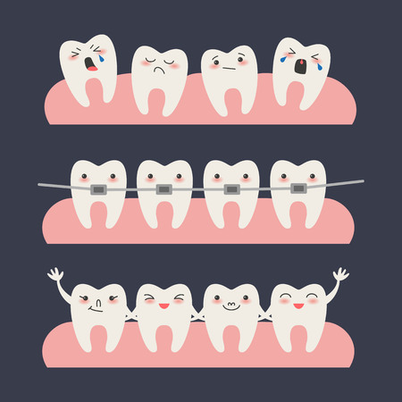 Cartoon Teeth with braces on dark background Vector illustration.のイラスト素材