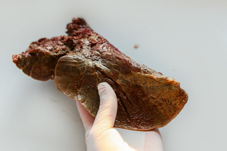 a piece of lung in the hands of the doctor. Affected organs, smoker, tuberculosis, covid virus....
