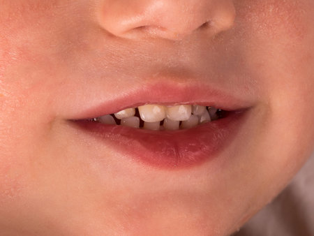 Baby smile close-up. Baby teeth. Macro.
