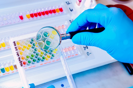 Petri dish. Microbiological laboratory. Mold and fungal cultures. Bacterial researchの写真素材