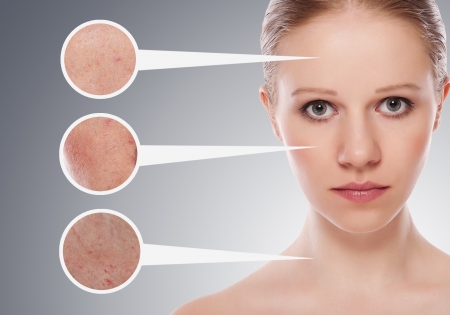 concept skincare. Skin of beauty young woman の写真素材