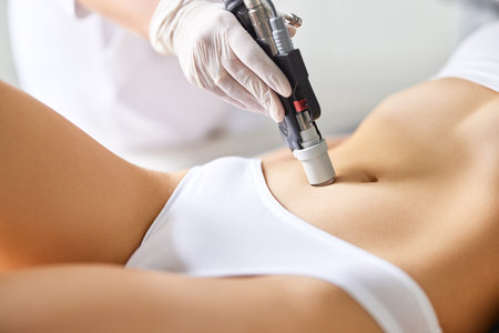 Crop anonymous female patient receiving laser skin care procedure on stomach during appointment in...