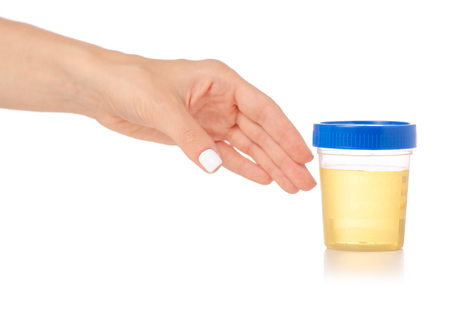 Plastic container with urine in hand analysis on white background isolationの写真素材