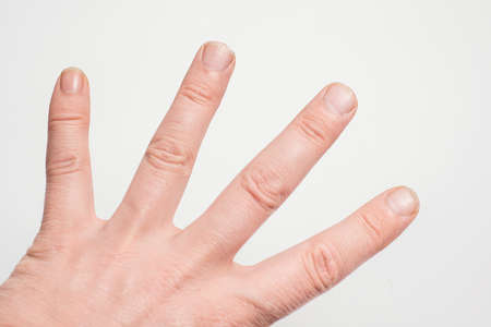 Close- up of long nails. Brittle nails on your finger . Concept of nail care and health.の写真素材