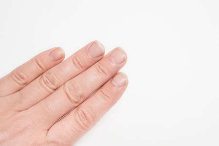 Close- up of long nails. Brittle nails on your finger . Concept of nail care and health.の写真素材