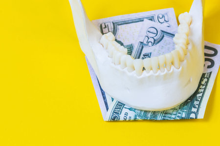 jaw of a human with teeth and banknotes of money,dentistry implantation price